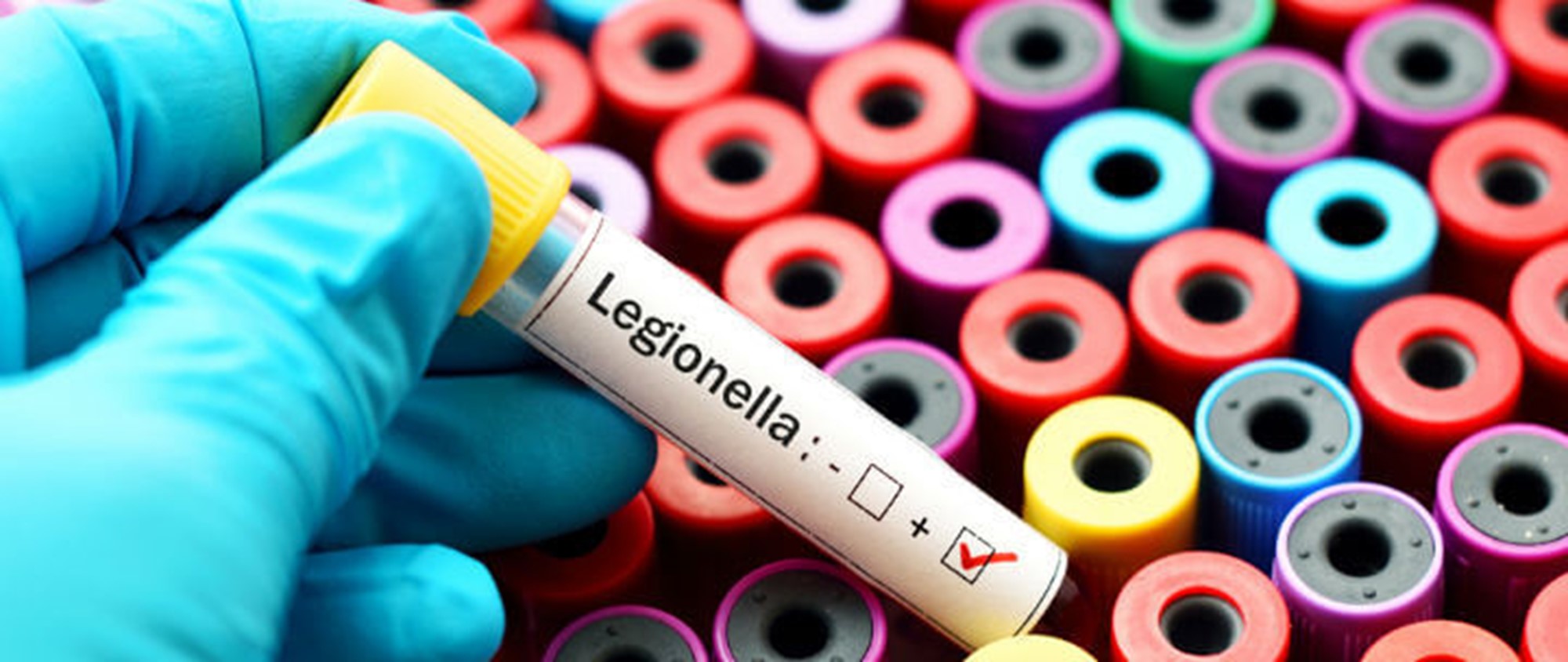 Legionella Sampling & Analysis